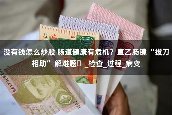 没有钱怎么炒股 肠道健康有危机？直乙肠镜 “拔刀相助” 解难题​_检查_过程_病变